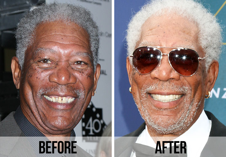 The Evolution of Celebrity Smiles Through Modern Dentistry…